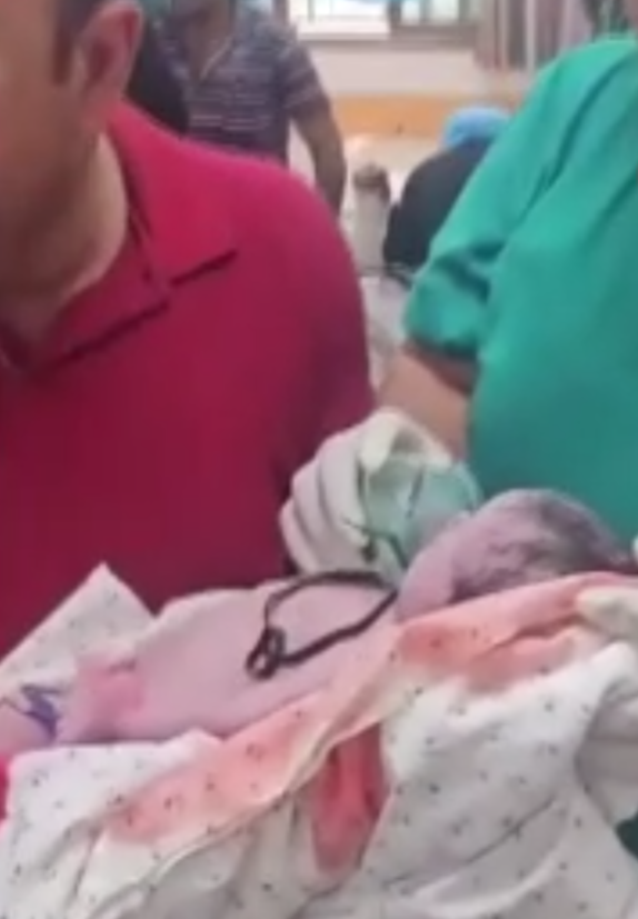 DÜNYA'YA GÖZLERİNİ ANNESİ OLMADAN AÇTI