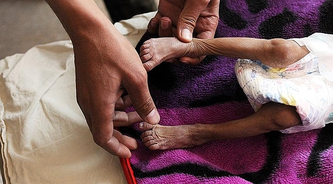 Milyonlarca Yemenli aç uyuyor