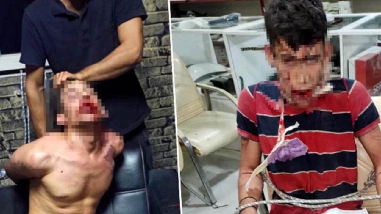 3 Gün Boyunca Böcek Yedirip, Dişlerini Kırdılar!