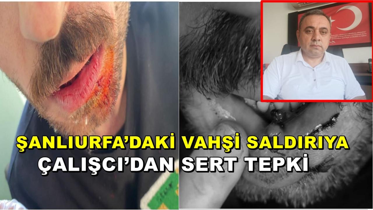 Şanlıurfa’daki Vahşi Saldırıya Çalışcı’dan Sert Tepki!