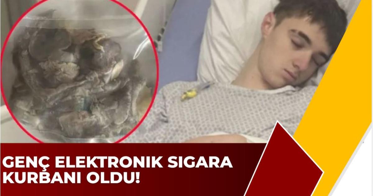 Genç Elektronik Sigara Kurbanı Oldu!