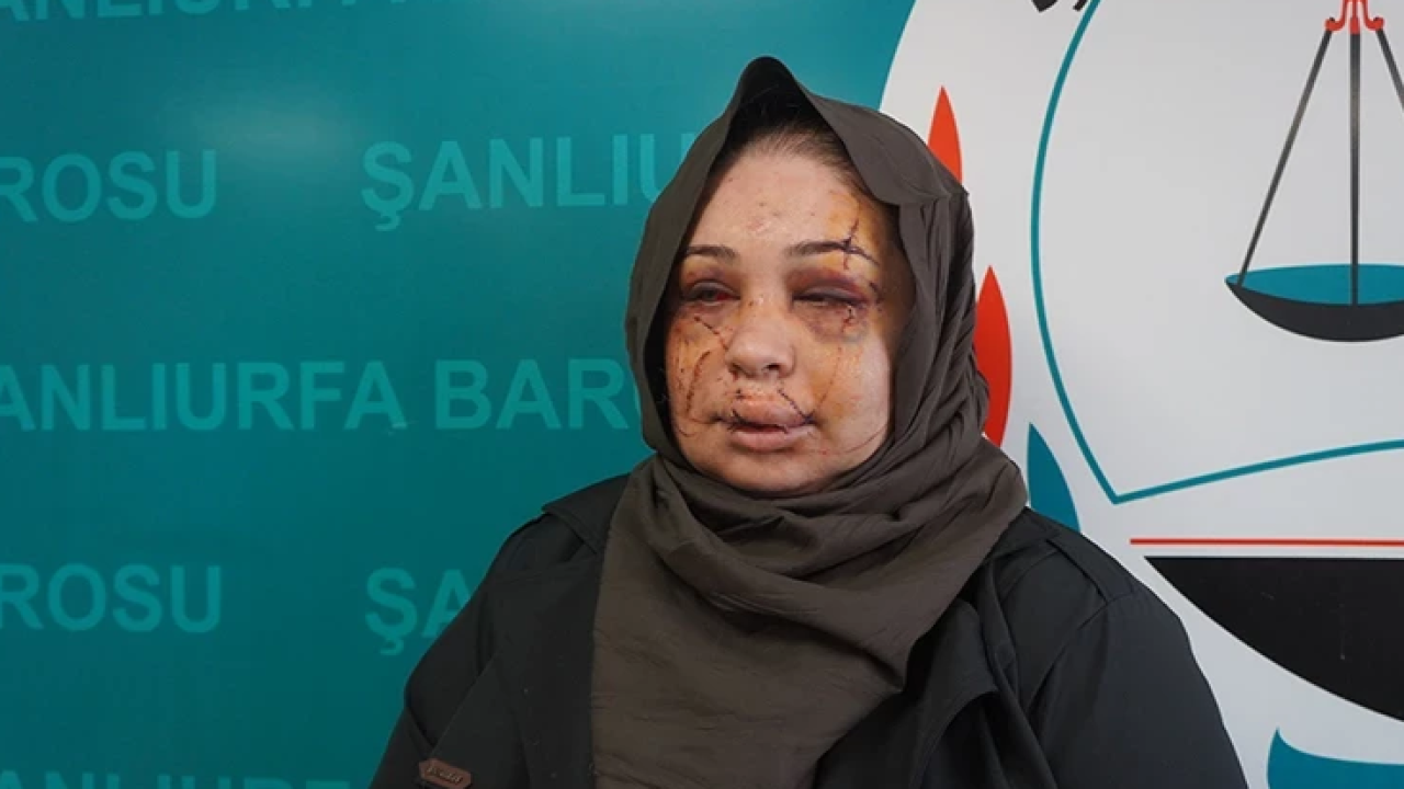 Bakan Göktaş: Şiddete Uğrayan Kardeşimizin Yanındayız