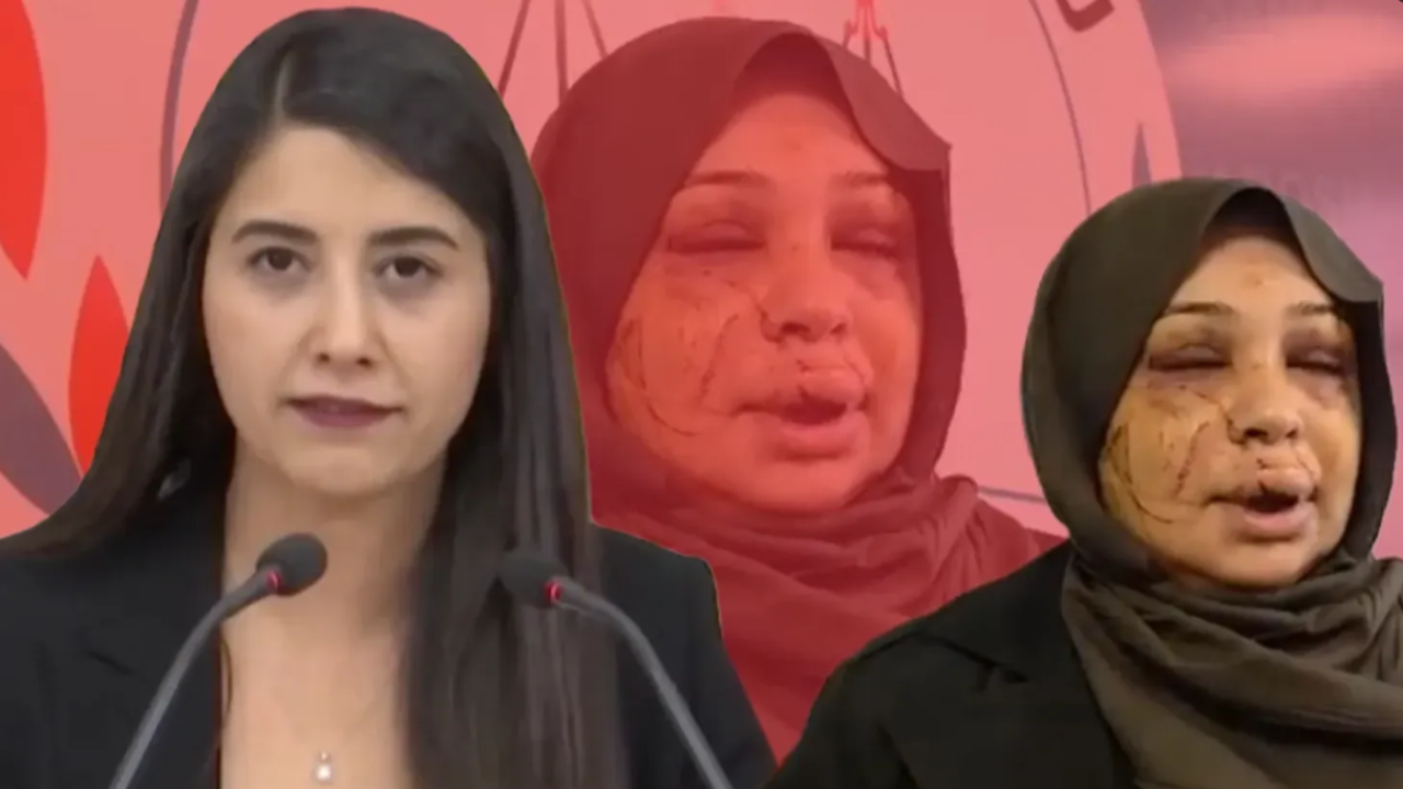 Dilan Kunt Ayan’dan Serbestlik Kararına Tepki