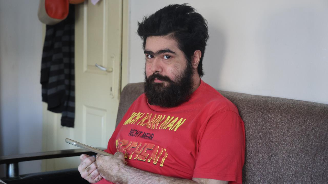 Deprem sonrası tedaviyi reddeden Barış sanal dünyaya tekrar döndü!