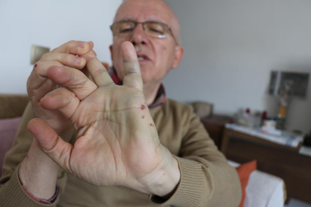 Beğenmediği Mandalinayı İade Etmek İstedi, Darp Edildi