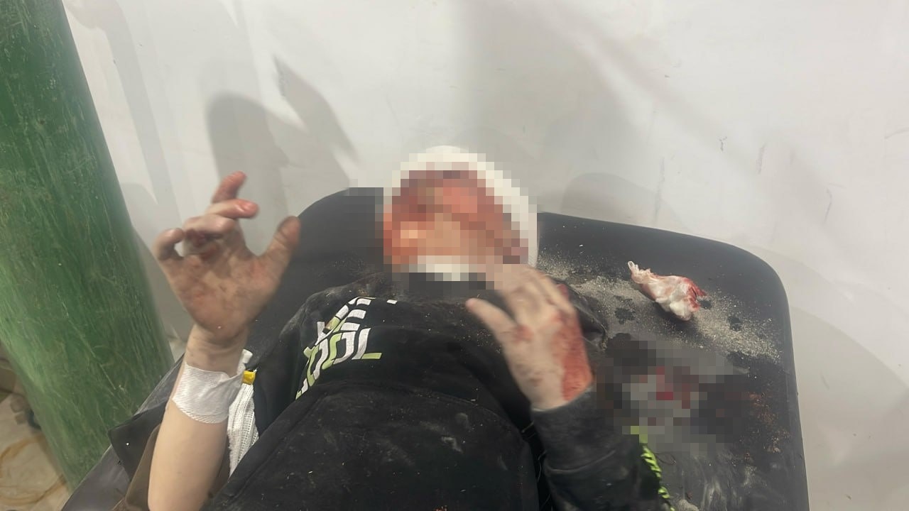 İsrail’in Gazze Saldırısında 230 Can Kaybı