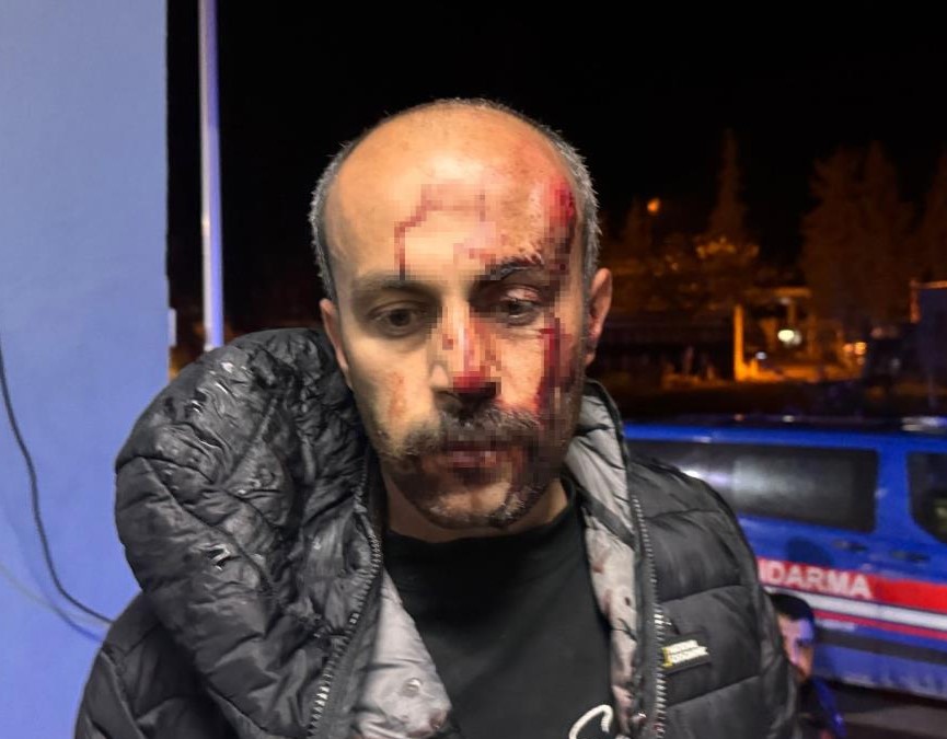 Şanlıurfa'da Trafik Kontrolünde Gerginlik