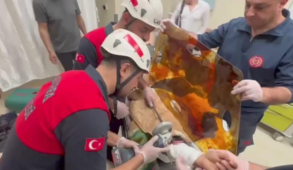 Demir Şiş Kolunu Delip Geçti