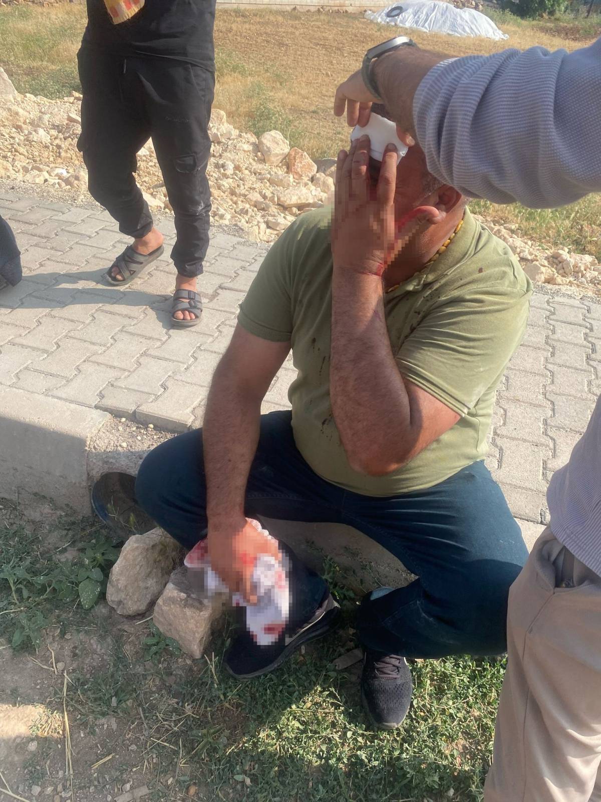 Şanlıurfa’da Çocuk Kavgası Kanlı Bitti!