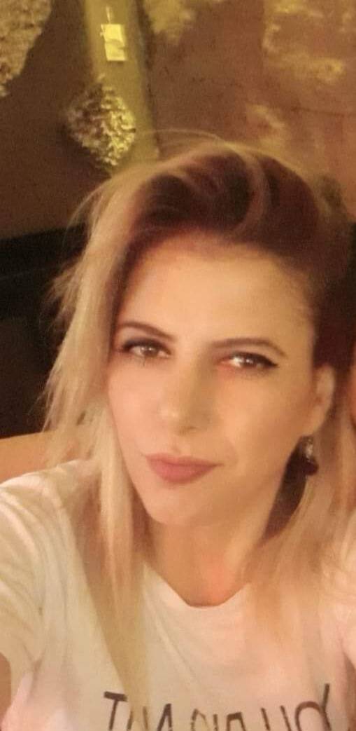 Eski Sevgilisi Kezzapla Yüzünü ve Ellerini Eritti
