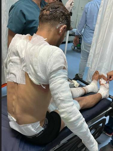 Şanlıurfa’da Tarlada Yangın Faciası: 1 Ağır 5 Yaralı