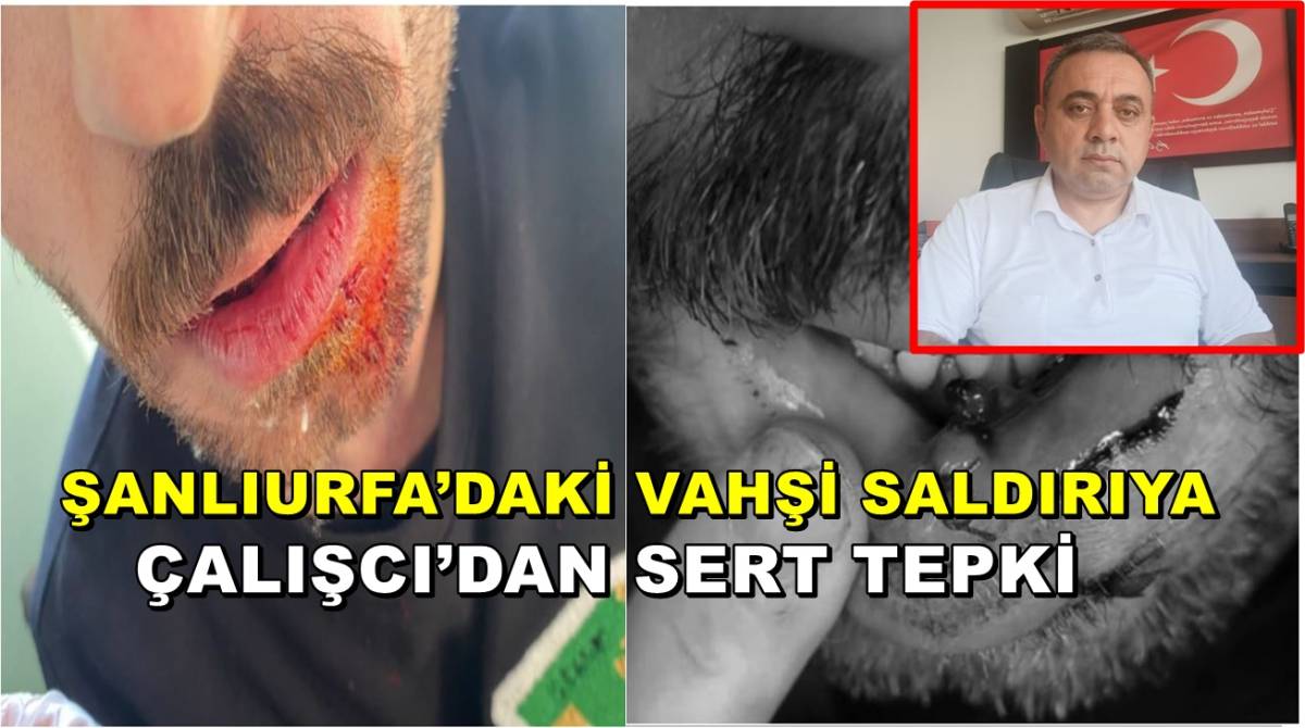 Vahşet Anı: Şanlıurfa'da Hemşireye Tekmeli Saldırı