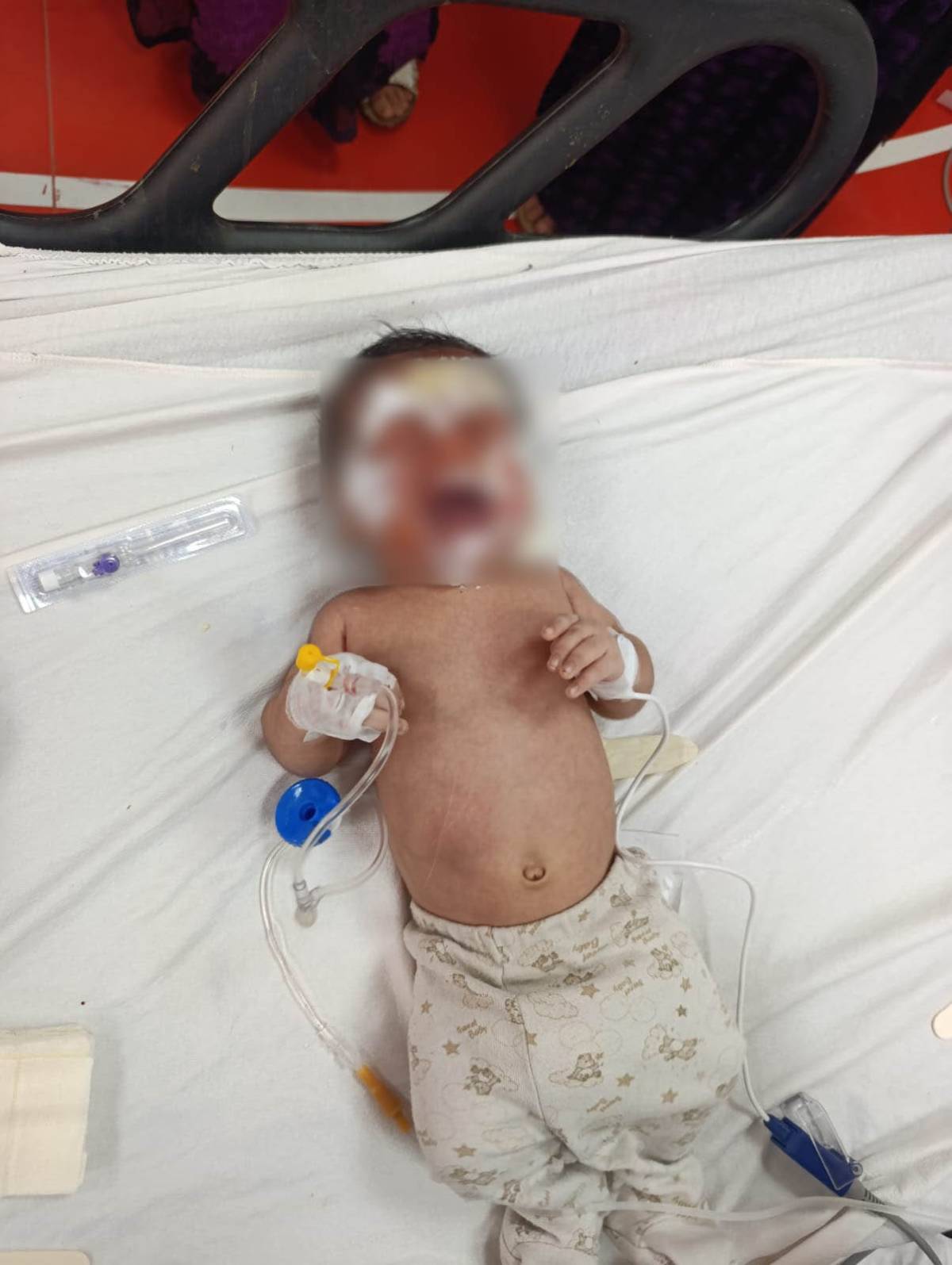 Şanlıurfa'da Akıl almaz Olay: Kendiliğinden Yanan Ev Bebeği Yaktı!