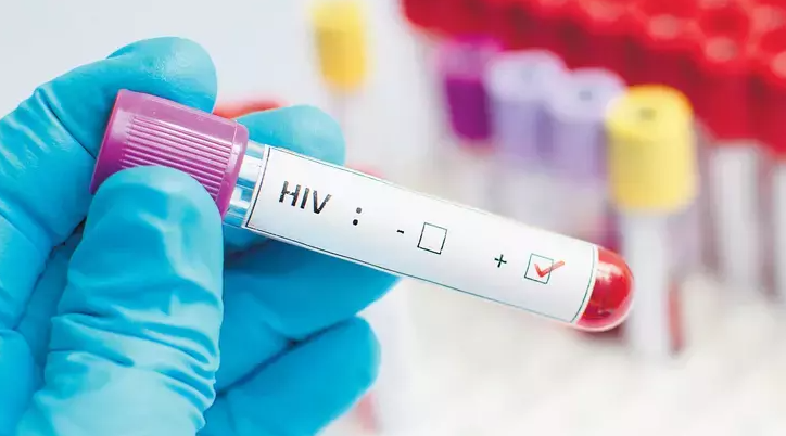 Şanlıurfa’dan 1 Aralık HIV/AIDS Mesajı: Erken Tanı Şart