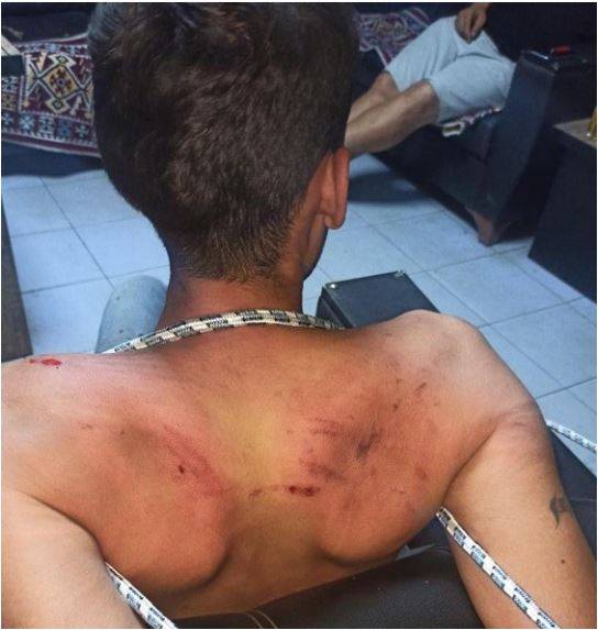 Şanlıurfalı Gence Hamam Böceği Yedirdiler! Karar Açıklandı