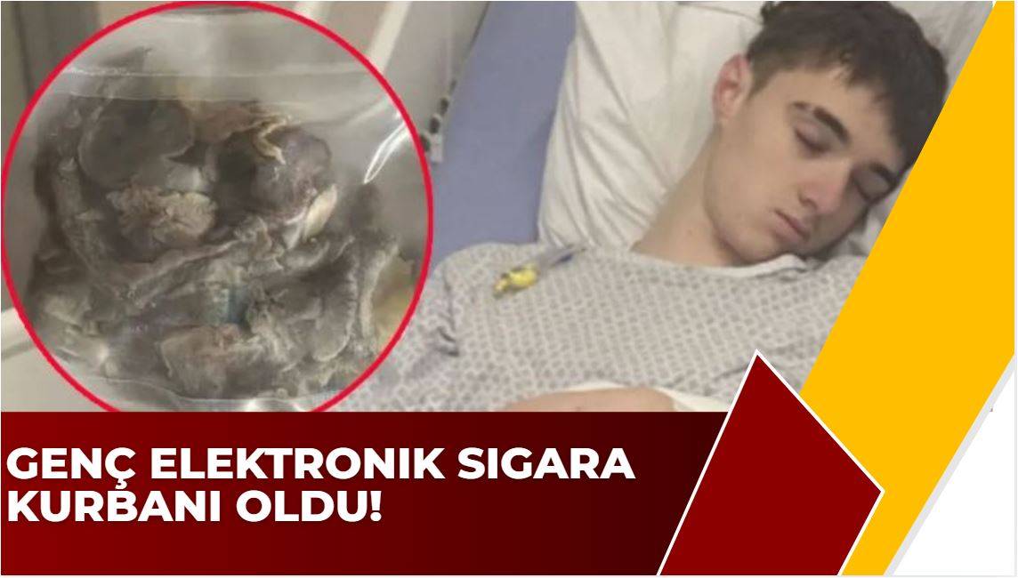 Genç Elektronik Sigara Kurbanı Oldu!