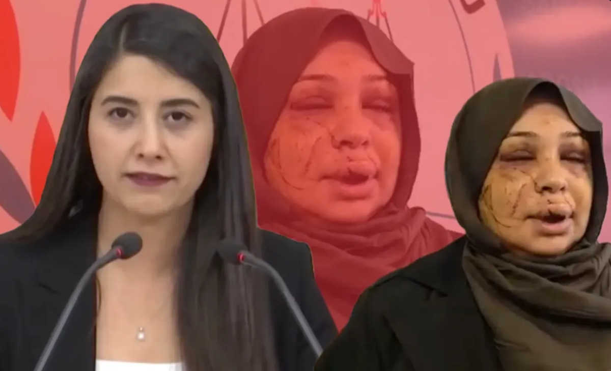 Dilan Kunt Ayan’dan Serbestlik Kararına Tepki