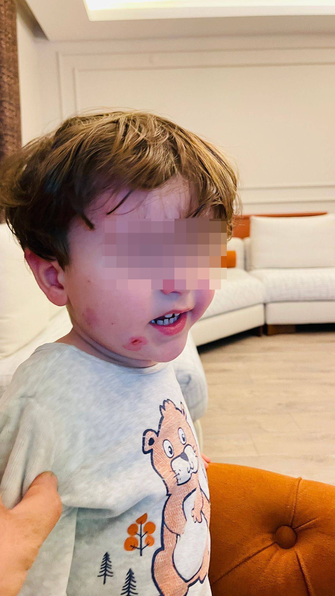 Kreşte skandal olay: Çocuğunu darp edilmiş halde buldu!