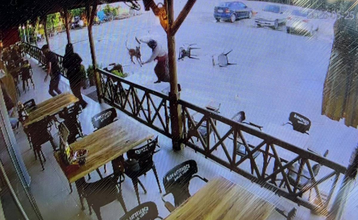 Tekmelere aldırmayan köpek kadının kolunu kopardı!