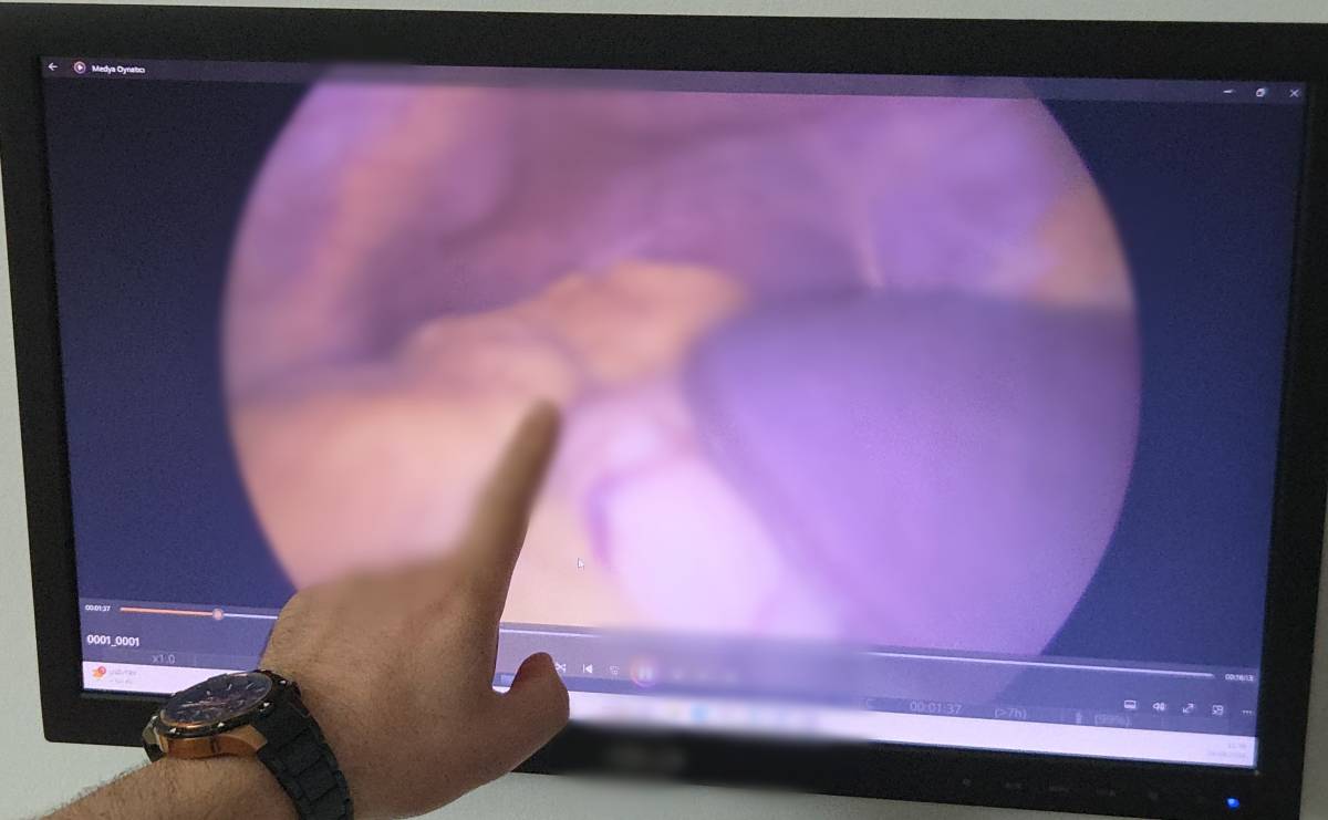 Tüm organları ters yerde: Doktorlar bile şaşırdı!